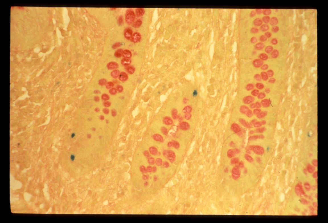 term image