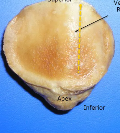 <p>What bone structure is this?</p>