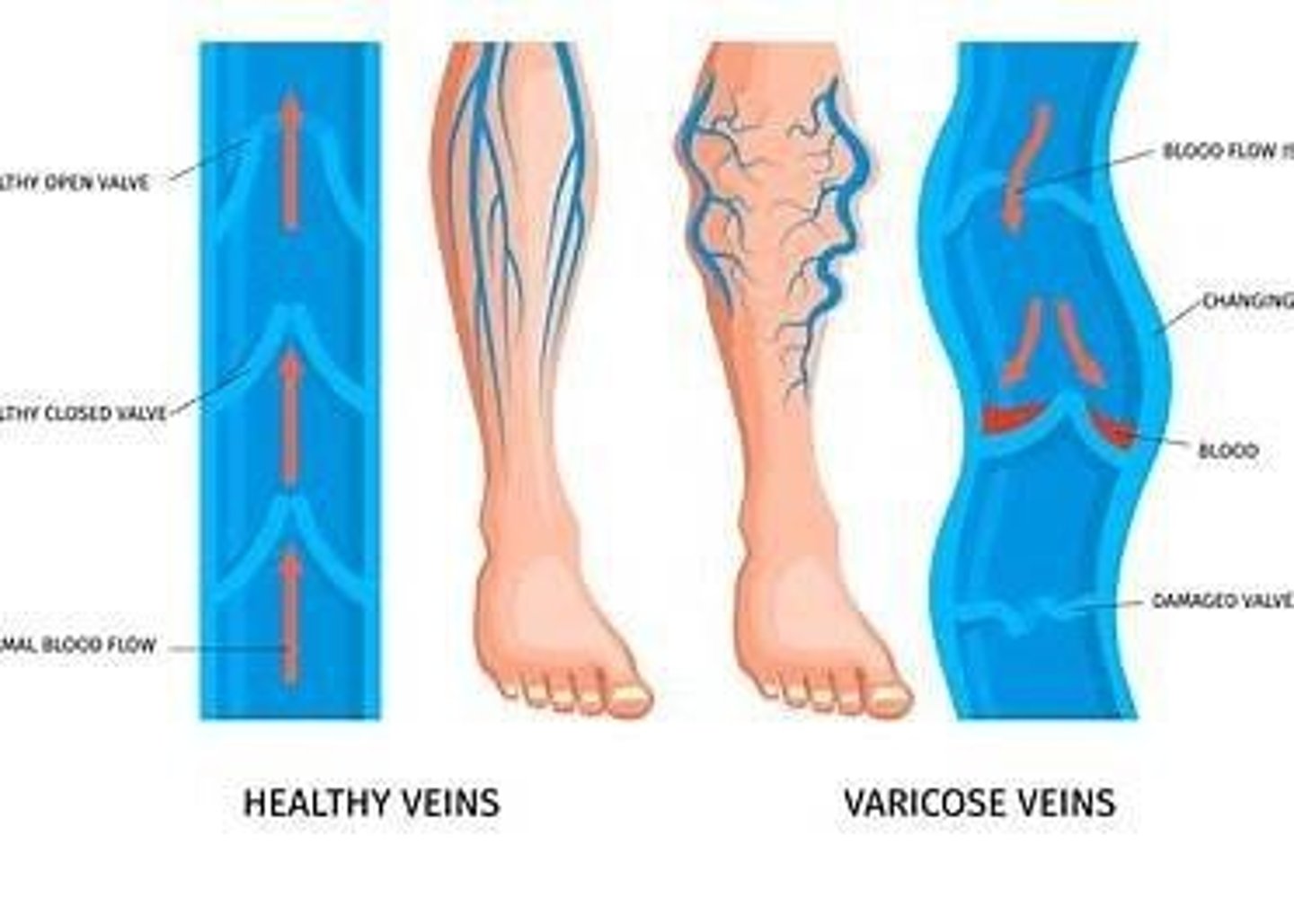 <p>Muscle atrophy, pallor, and erythema.</p>