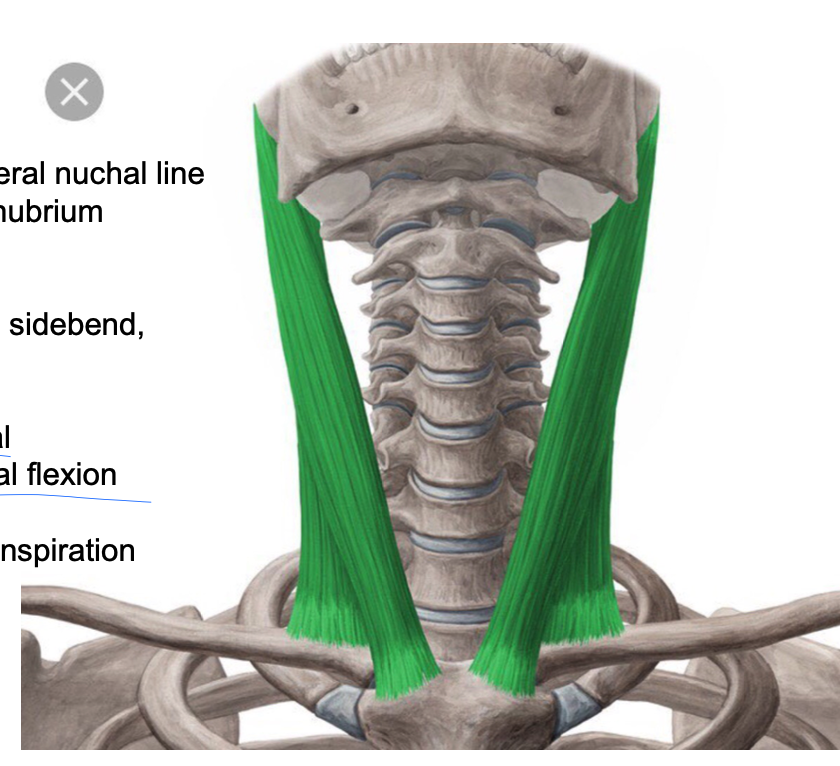 <p>PA: mastoid process/lateral nuchal line </p><p>DA: medial clavicle, manubrium </p><p>Inn: CN XI for efferent (motor), C3, C4 for afferent (sensory)</p><p>A: unilateral: ipsalateral sidebend and contralateral rotation, bilateral: upper cervical extension and lower cervical flexion </p><p>Reverse action: secondary inspiration </p>