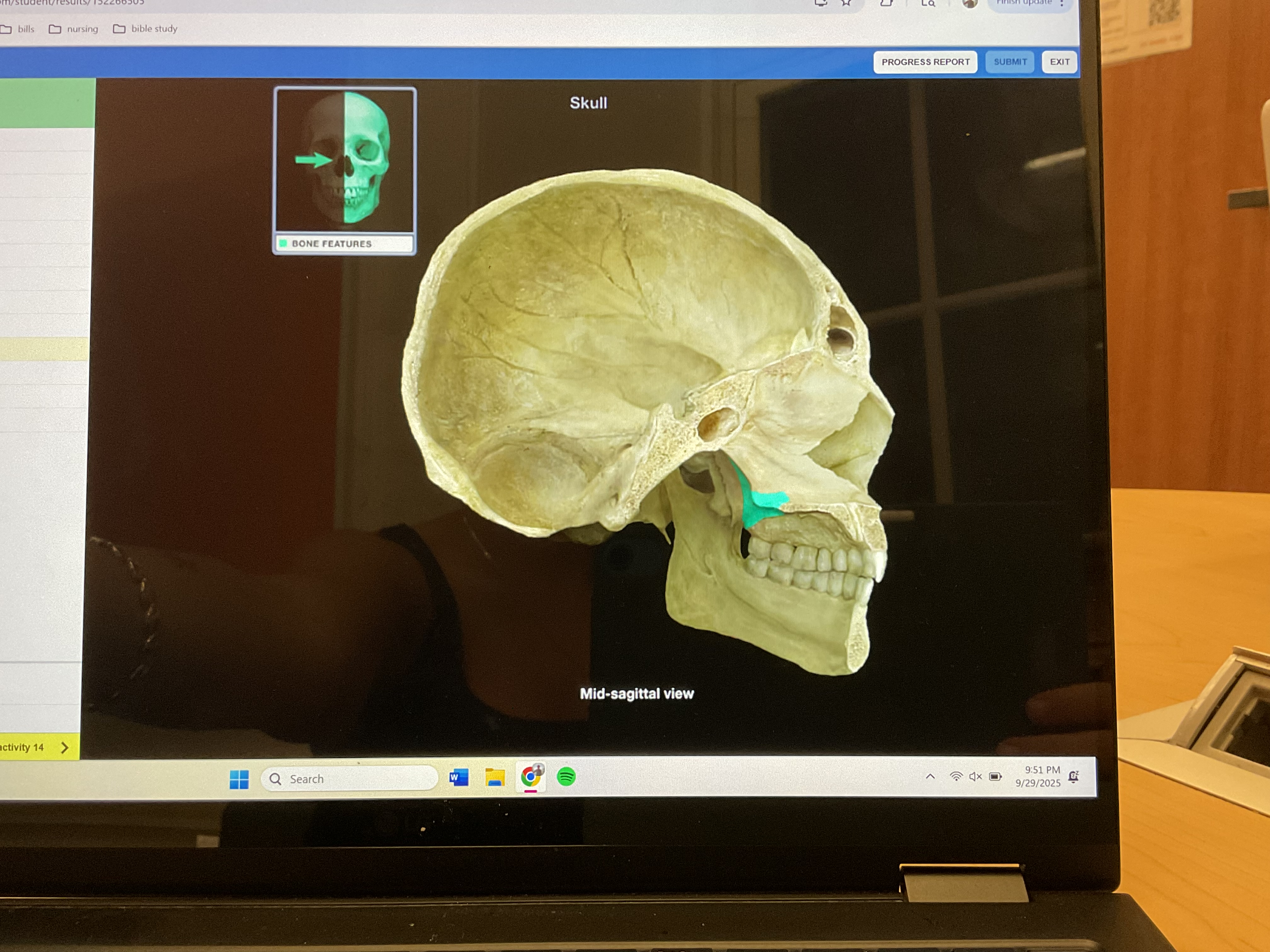 <p>Palatine bone </p>