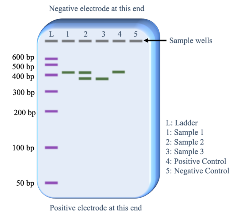 <p><span>In the case of the figure, which one matches with the control?</span></p>