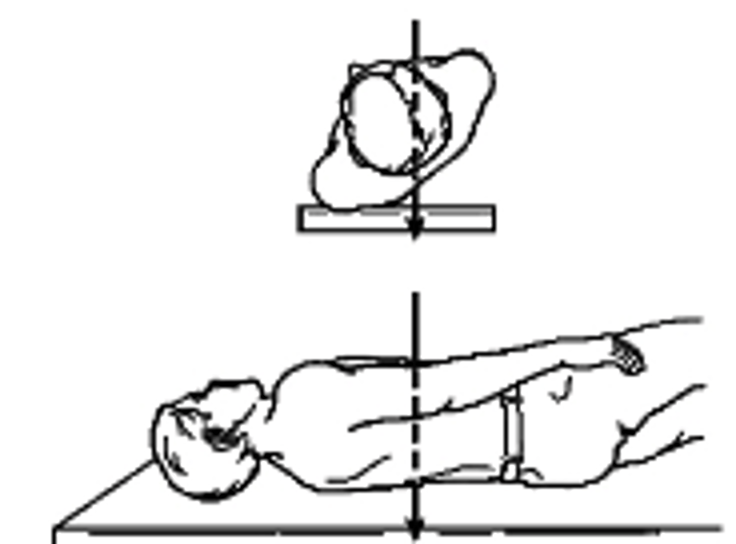 <p>what type of projection is this?</p><p>a. Left lateral</p><p>b. Right Lateral</p><p>c. Left AP Oblique</p><p>c. Right AP Oblique</p>