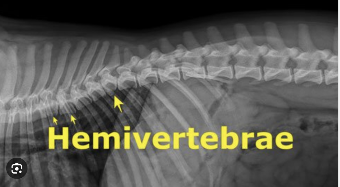 <p>hemivertebra</p>