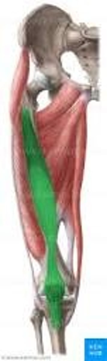 <p>quad muscle deep to rectus femoris</p>