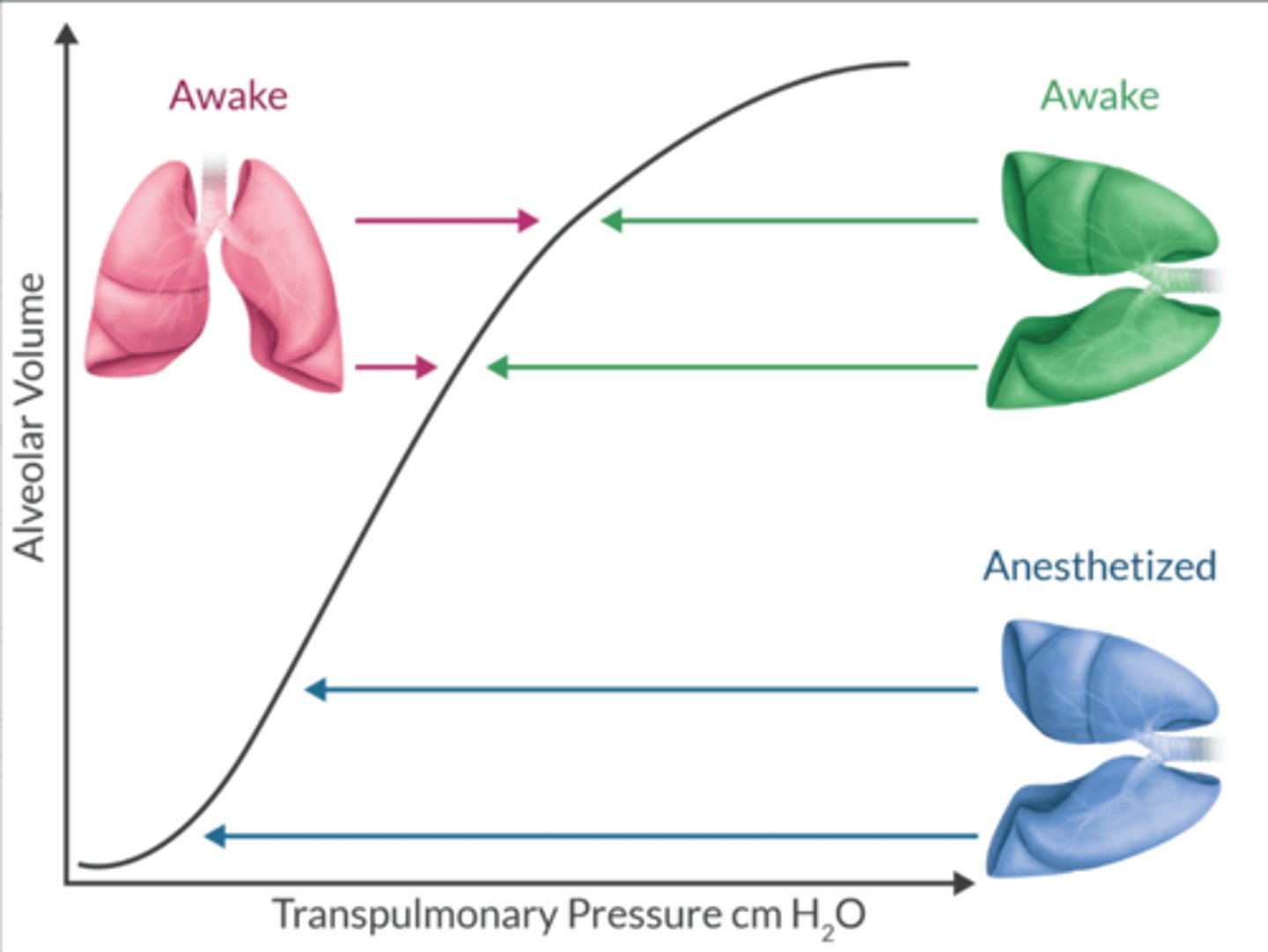 <p>Nondependent lung:</p><p>-moves from a flatter region (less compliant) to an area of better compliance (slope)</p><p>-ventilation is optimal</p><p>Dependent lung:</p><p>-moves from the slope to the lower, flatter area of the curve (less compliant)</p><p>-perfusion is best in this lung (gravity)</p><p>-↓ of alveolar V contributes to atelectasis </p><p>The net effect: ventilation is better in the nondependent lung. </p><p>-creates V/Q mismatch + ↑ risk of hypoxemia during OLV. </p>