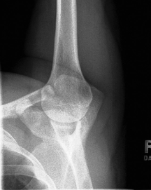 <p>name the position/projection and method if applicable&nbsp;</p>