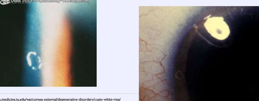<p>What condition is this?</p>