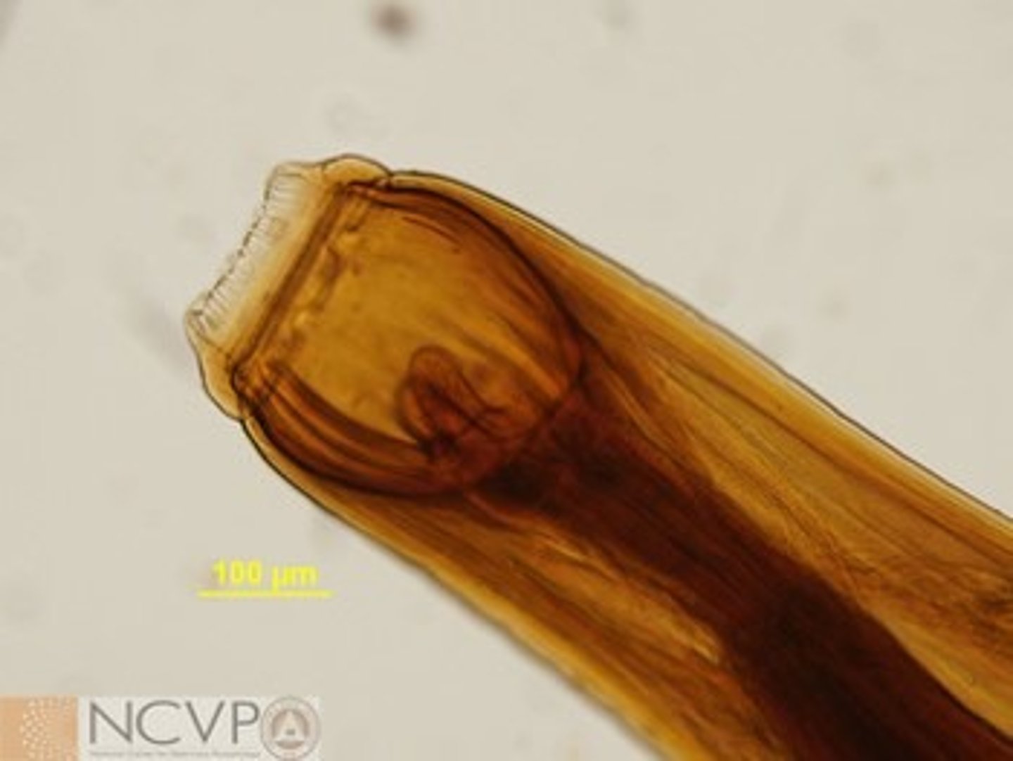 <p>most deadly GI parasite of horses</p><p>migrate through arteries and cause thromboembolism</p>