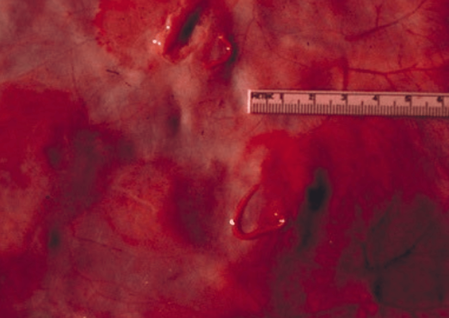 <p>L4 in the peritoneum of the right flank of a horse. what species is this ?</p>