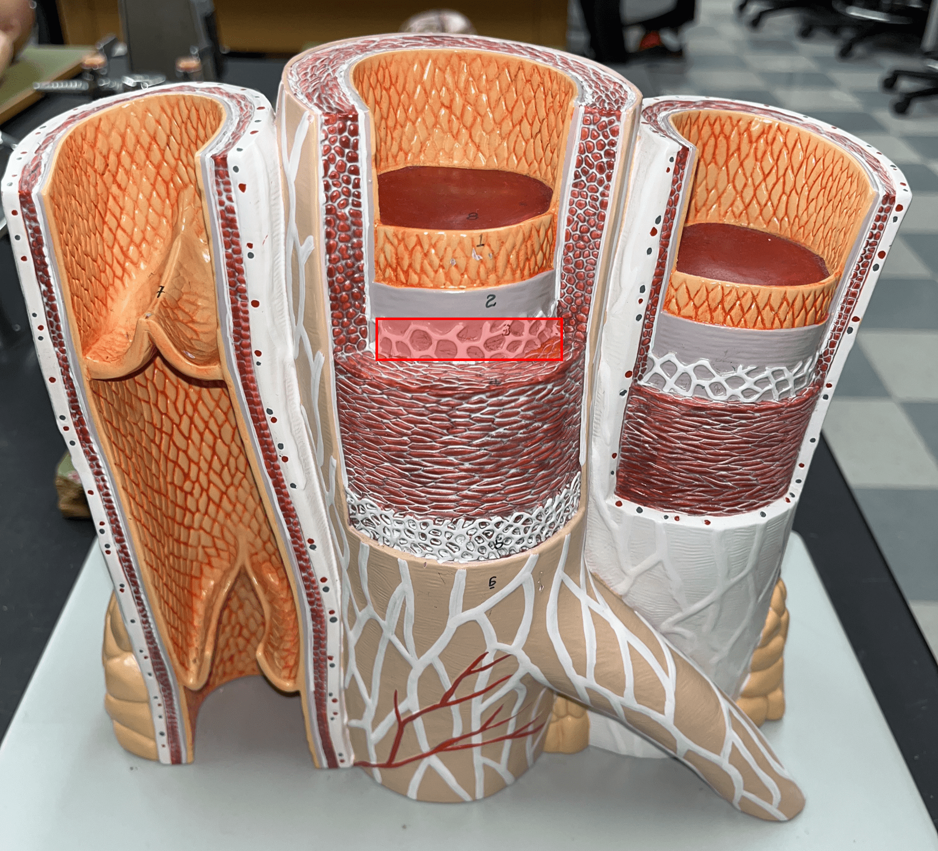<p>• A thin layer of elastic connective tissue.</p>
<p>• Found between the tunica media and tunica interna.</p>
<p>• Allows the lumen of a blood vessel to stretch.</p>