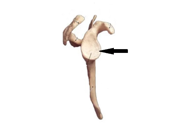 <p>what is this cavity?</p>