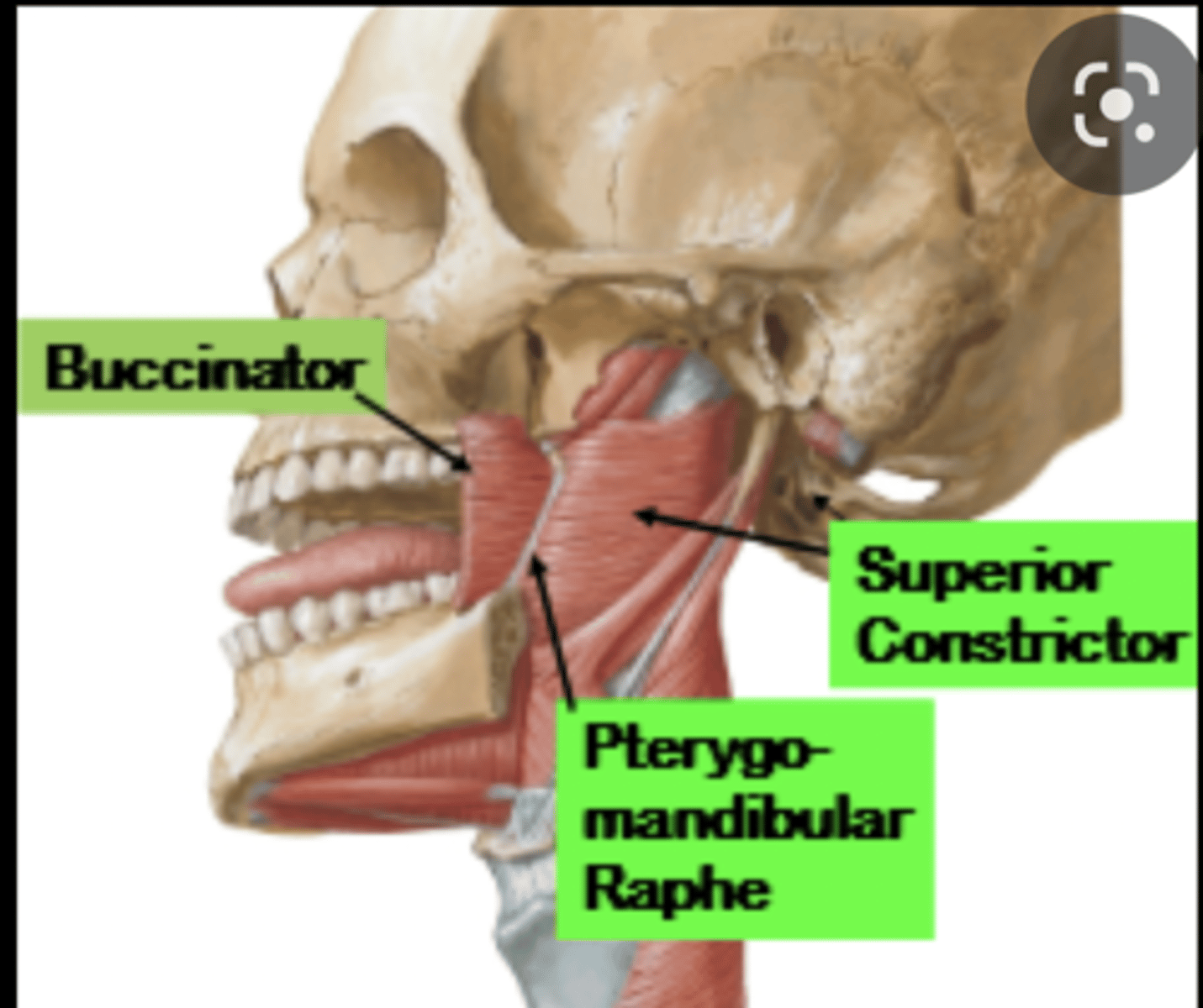 <p>lateral aspects of md/mx alveolar processes and pterygomandibular raphe</p>