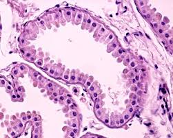 <p>A type of gland in the skin that secretes a thicker, milky fluid into hair follicles.</p>