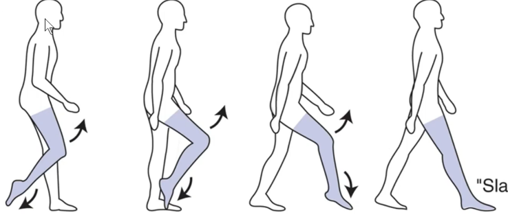 <p>What kind of gait is this</p>
