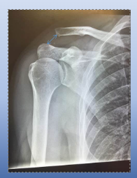 <p>what is this an x-ray of?</p>