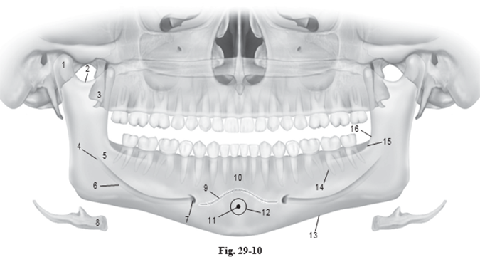 <p>Which number is the <strong>Mental Foramen?</strong></p>