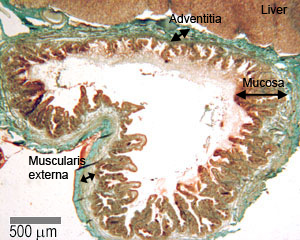 <ul><li><p>mucosa → simple columnar epithelium + microvilli </p></li><li><p><mark data-color="yellow" style="background-color: yellow; color: inherit">NO muscularis mucosa + submucosa </mark></p></li><li><p>Muscularis externa </p></li><li><p>Adventitia where it connects with liver </p></li><li><p>Serosa elsewhere (mesothelium + loose CT) </p></li></ul><p></p>