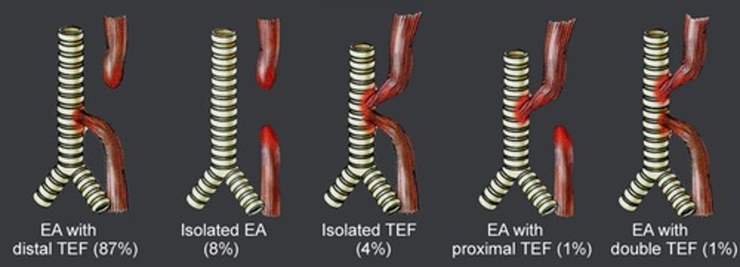 <p>EA w/ distal TEF (though there are several possible combos)</p>