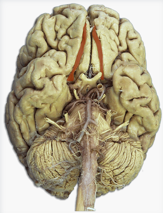 <p>Label this cranial nerve</p>
