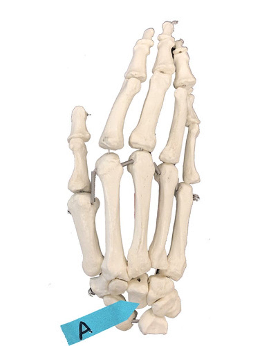 <p>Identify this group of bones.</p>