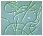 <p>What is the name of this bacterium?</p>