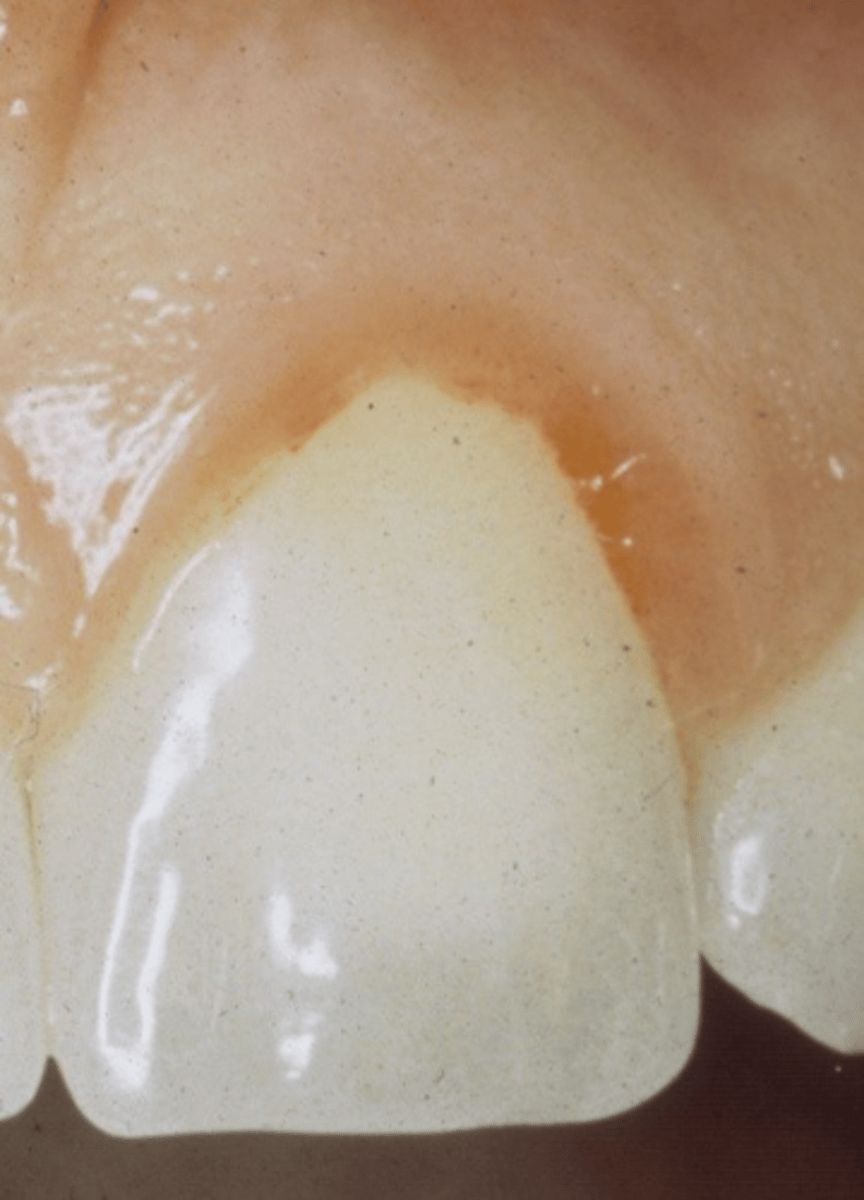 <p>ID the problem:</p>