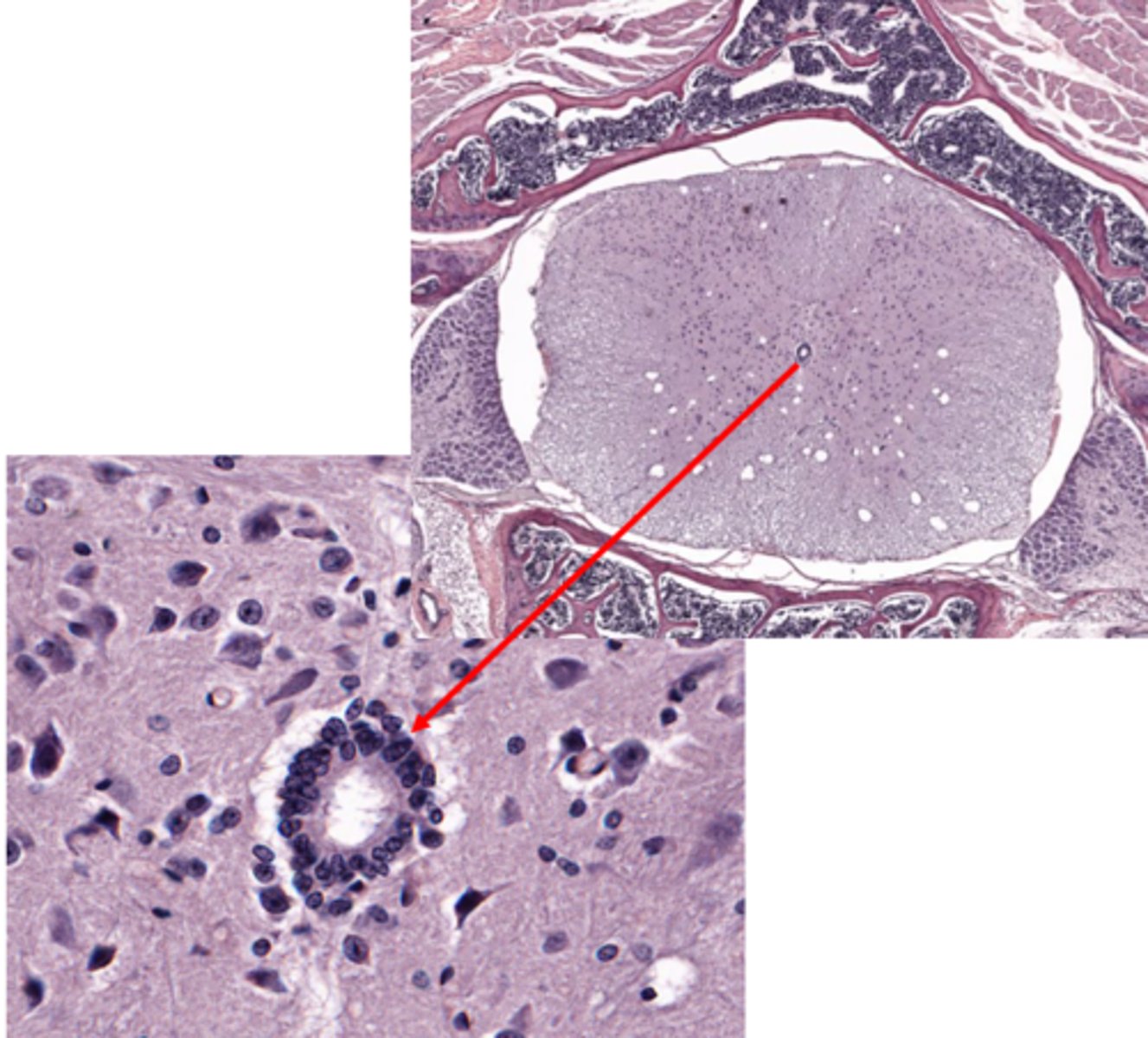 <p>Identify the cells that line the ventricles of the brain and the central canal of the spinal cord</p>