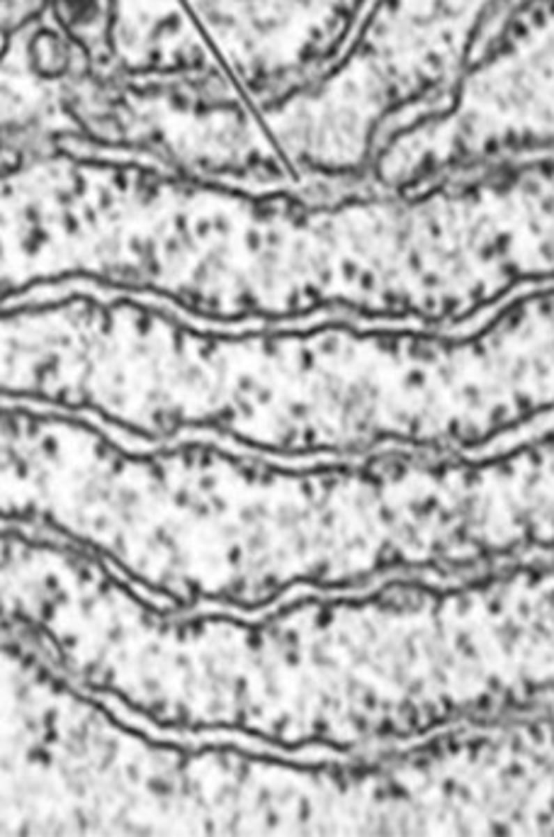 <p>has a granulated appearance due to the presence of ribosomes</p><p>- Processes proteins that have a special destination, either inside or outside the cell (PSD - proteins with a special destination).</p><p>- Building new membrane</p>