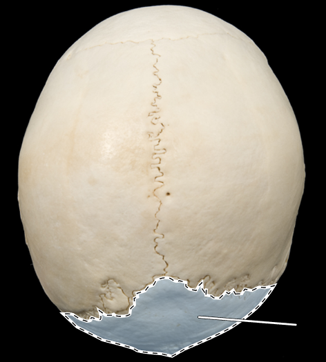 <p>Name this bone.</p><p>(Skull, superior view).</p>