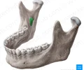 <p><span>Thin, posteriorly-directed bony projection<br>Provides attachment for sphenomandibular ligament<br>Landmark for inferior alveolar nerve block in dentistry</span></p>
