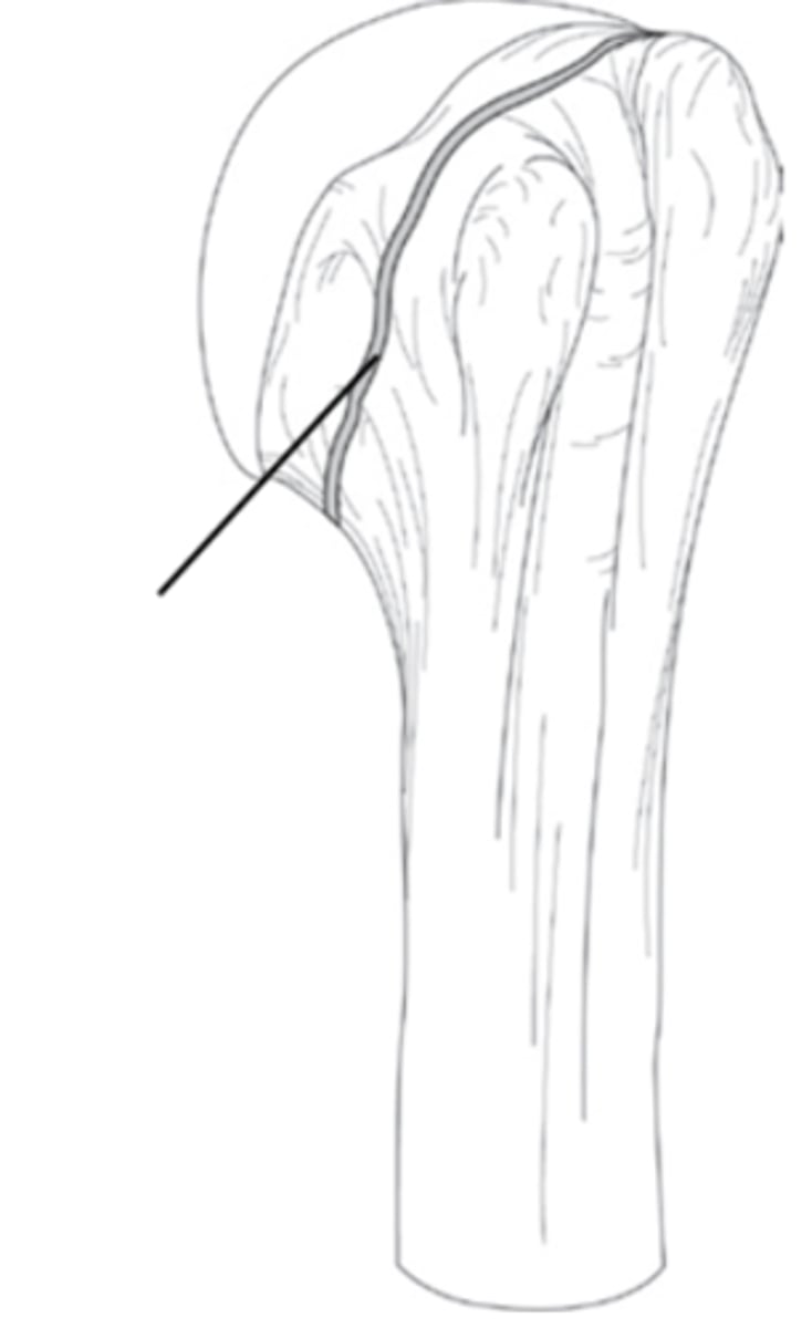 <p>What is the structural classification of this joint?</p>