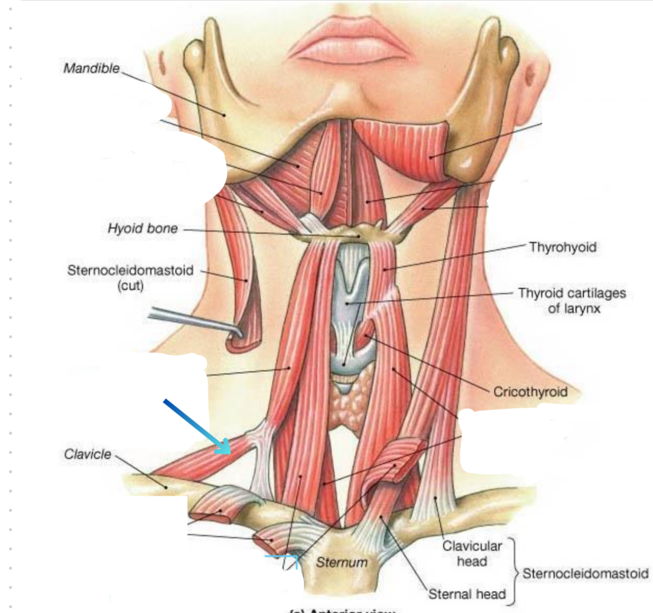 term image