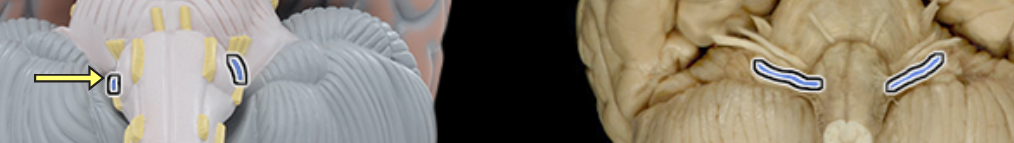 <p>Location:</p><ul><li><p>Posterior cranial fossa</p></li><li><p>Neck</p></li></ul><p>Composition:</p><ul><li><p>Motor</p></li><li><p>General sensation</p></li><li><p>Special sensation</p></li><li><p>Parasympathetic</p></li></ul><p>Motor:</p><ul><li><p>Stylopharyngeus muscle</p></li></ul><p>General sensation:</p><ul><li><p>From middle ear, posterior 1/3 of tongue, and pharynx</p></li></ul><p>Special sensation:</p><ul><li><p>Taste from posterior 1/3 of tongue</p></li></ul><p>Sensory ganglion:</p><ul><li><p>Superior and inferior ganglia of glossopharyngeal nerve</p></li></ul><p>Parasympathetic:</p><ul><li><p>Parotid gland</p></li></ul><p>CNS connection:</p><ul><li><p>Motor: medulla oblongata (nucleus ambiguus)</p></li><li><p>General sensation: medulla oblongata (spinal nucleus of trigeminal nerve)</p></li><li><p>Special sensation: medulla oblongata (nucleus of solitary tract)</p></li><li><p>Parasympathetic: medulla oblongata (inferior salivatory nucleus)</p></li></ul><p>Cranial foramina:</p><ul><li><p>Jugular foramen</p></li></ul><p>Comment:</p><ul><li><p>Has two sensory ganglia (superior and inferior) on nerve in jugular foramen</p></li><li><p>Glossopharyngeal nerve also conducts visceral afferent (sensory) impulses from carotid sinus (monitors blood pressure) and carotid body (monitors blood oxygen and carbon dioxide)</p></li><li><p>Postganglionic parasympathetic cell bodies located in otic ganglion in infratemporal fossa</p></li><li><p>Glossopharyngeal nerve also known as CN IX</p></li></ul><p></p>