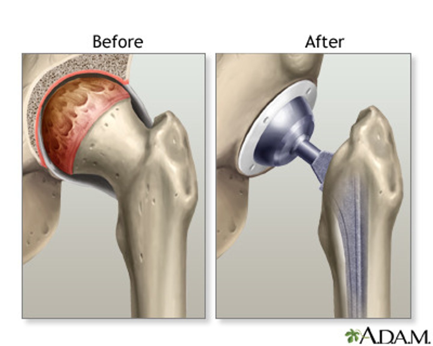 <p>- cant flex past 90 degrees</p><p>- should avoid internal rotation</p>