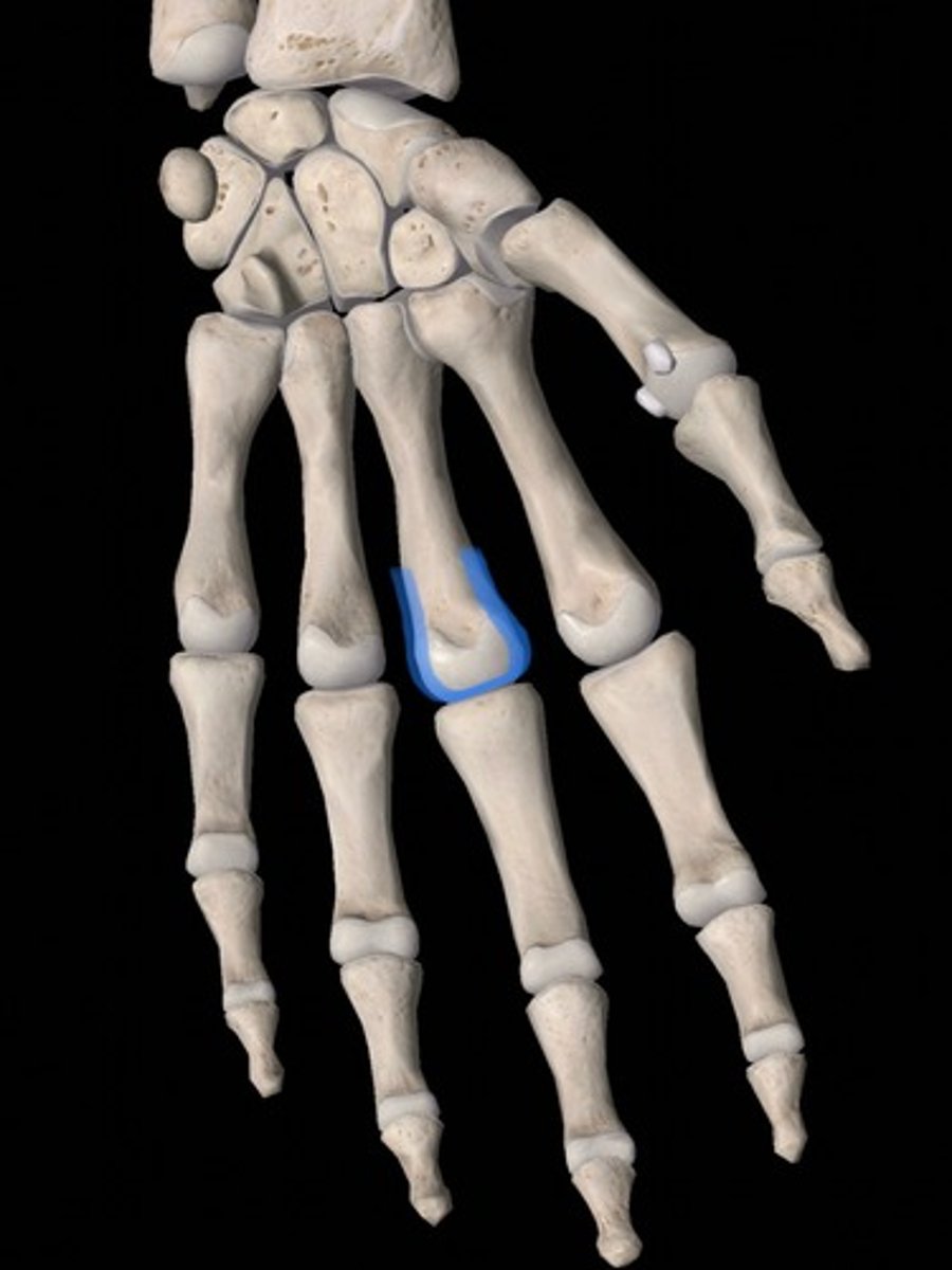 <p>bone</p>