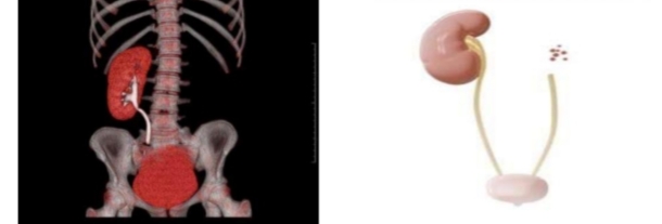 <p>identify then define</p>