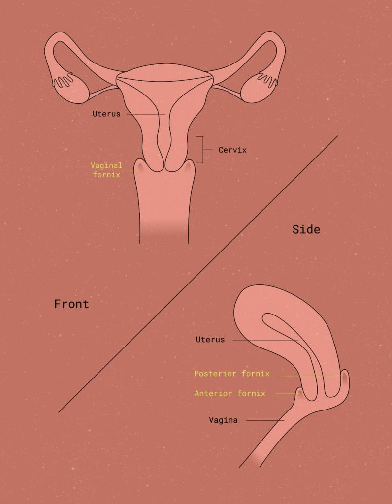 <p>C. fornix</p><p><strong>fornix</strong> is the recess or extension of the vaginal lumen that surrounds the intravaginal part of the cervix</p><ul><li><p>divided into anterior, posterior, and lateral fornices around the cervix.</p><ul><li><p class=""><strong>cervical canal</strong> is the passage within the cervix itself.</p></li><li><p class="">The <strong>uterine lumen</strong> is the cavity inside the body of the uterus.</p></li><li><p class="">The <strong>rectouterine pouch</strong> (pouch of Douglas) is the peritoneal space between the uterus and rectum.</p></li><li><p class="">The <strong>uterovesical pouch</strong> is the peritoneal space between the uterus and bladder.</p></li></ul></li></ul><p></p>