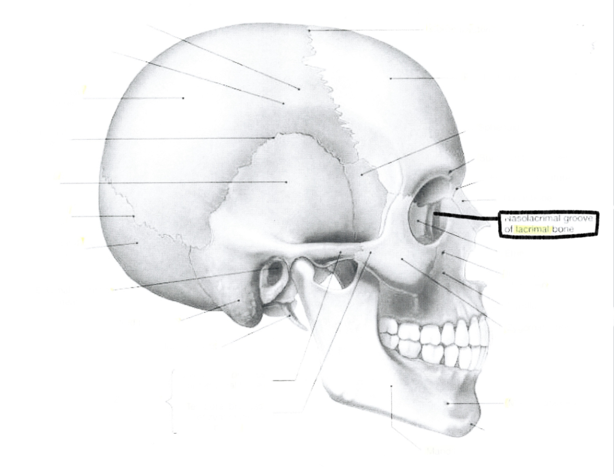 <p>Lacrimal bone</p>