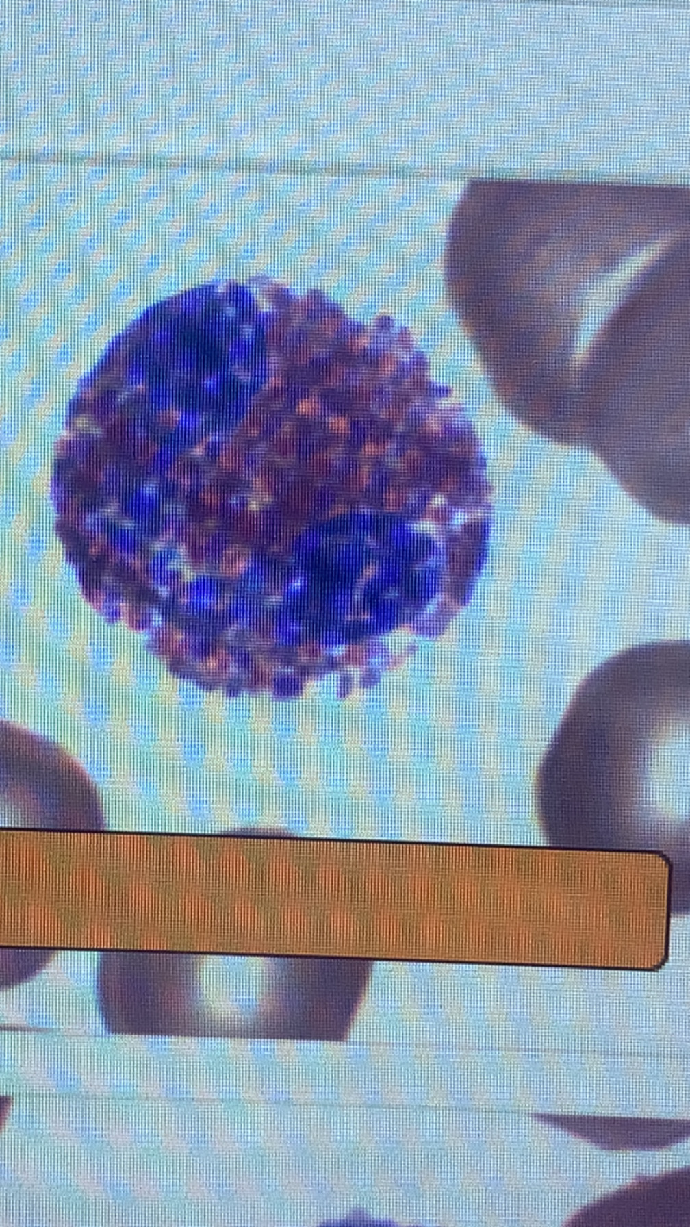 <p>eosinophil</p>
