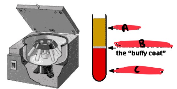 <p>B</p>
