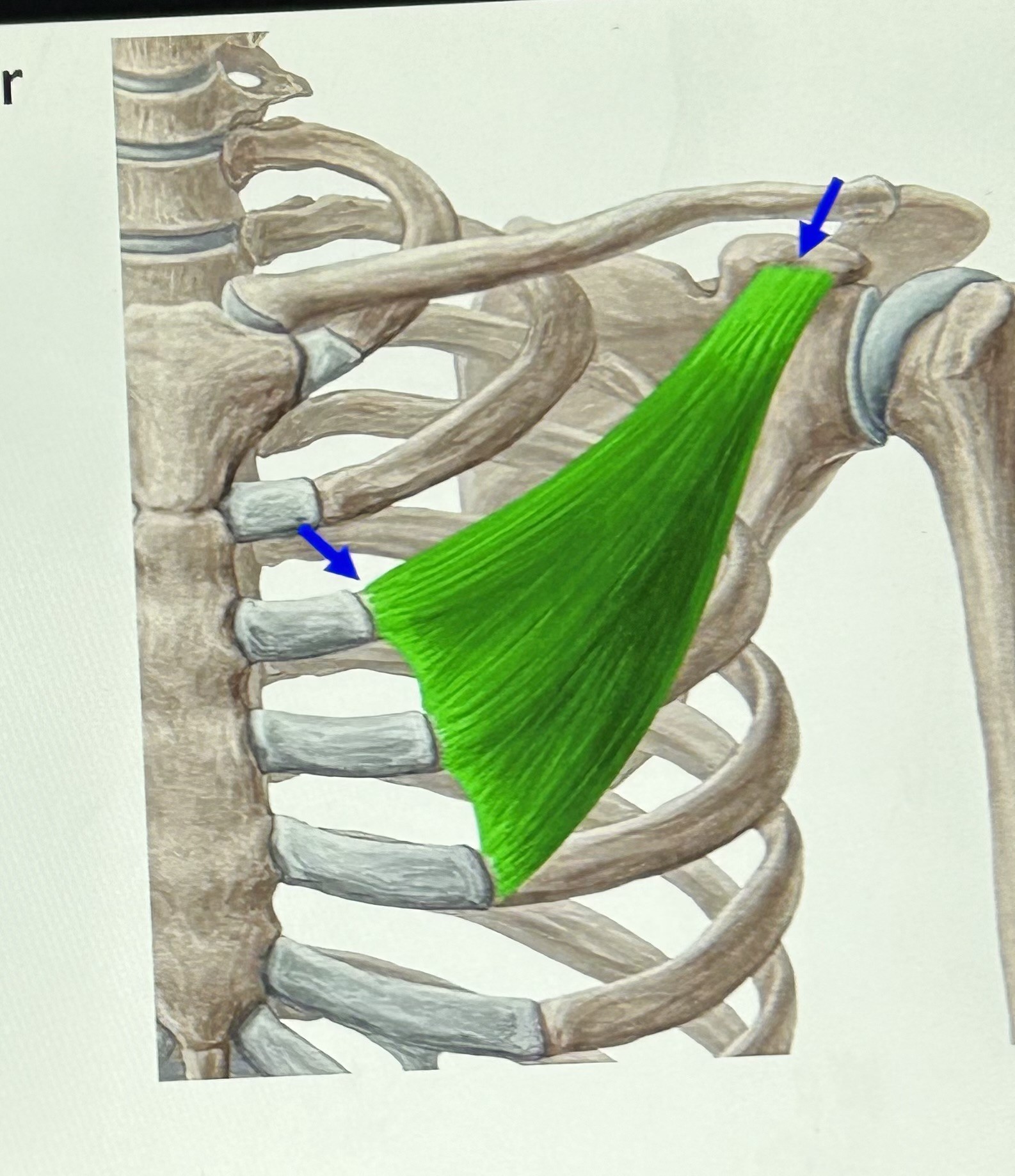 term image