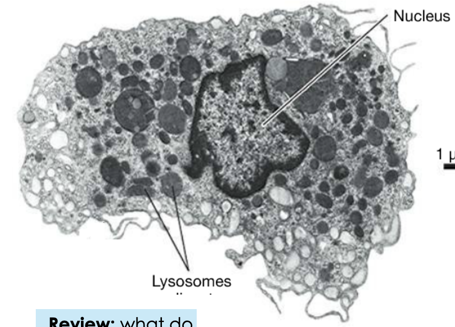 <p><span><span>This white blood cell </span></span></p>