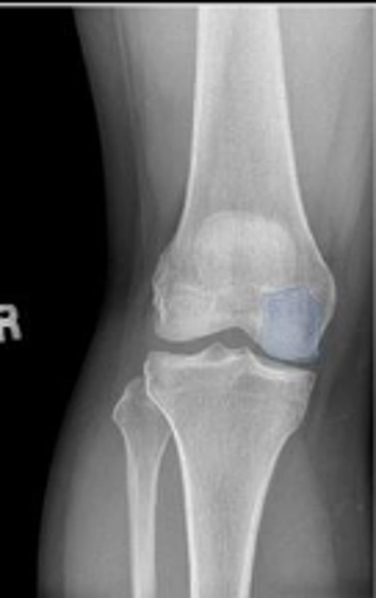 <p>What is outlined?</p>