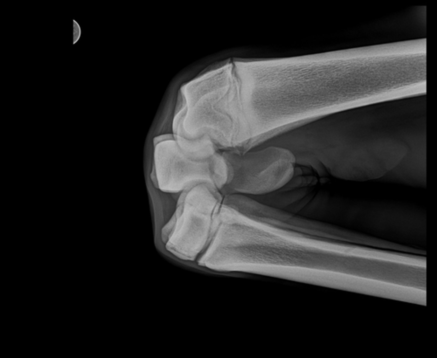 <p>Name the view and the anatomical region within the radiograph</p>