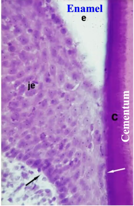 <p>what type of cementum is here</p>