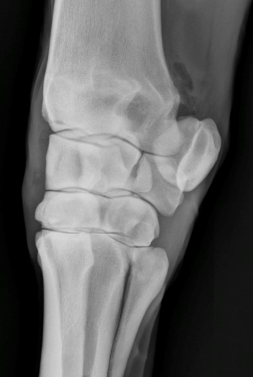 <p>What is highlighted in a DLPMO view of the carpus?</p>