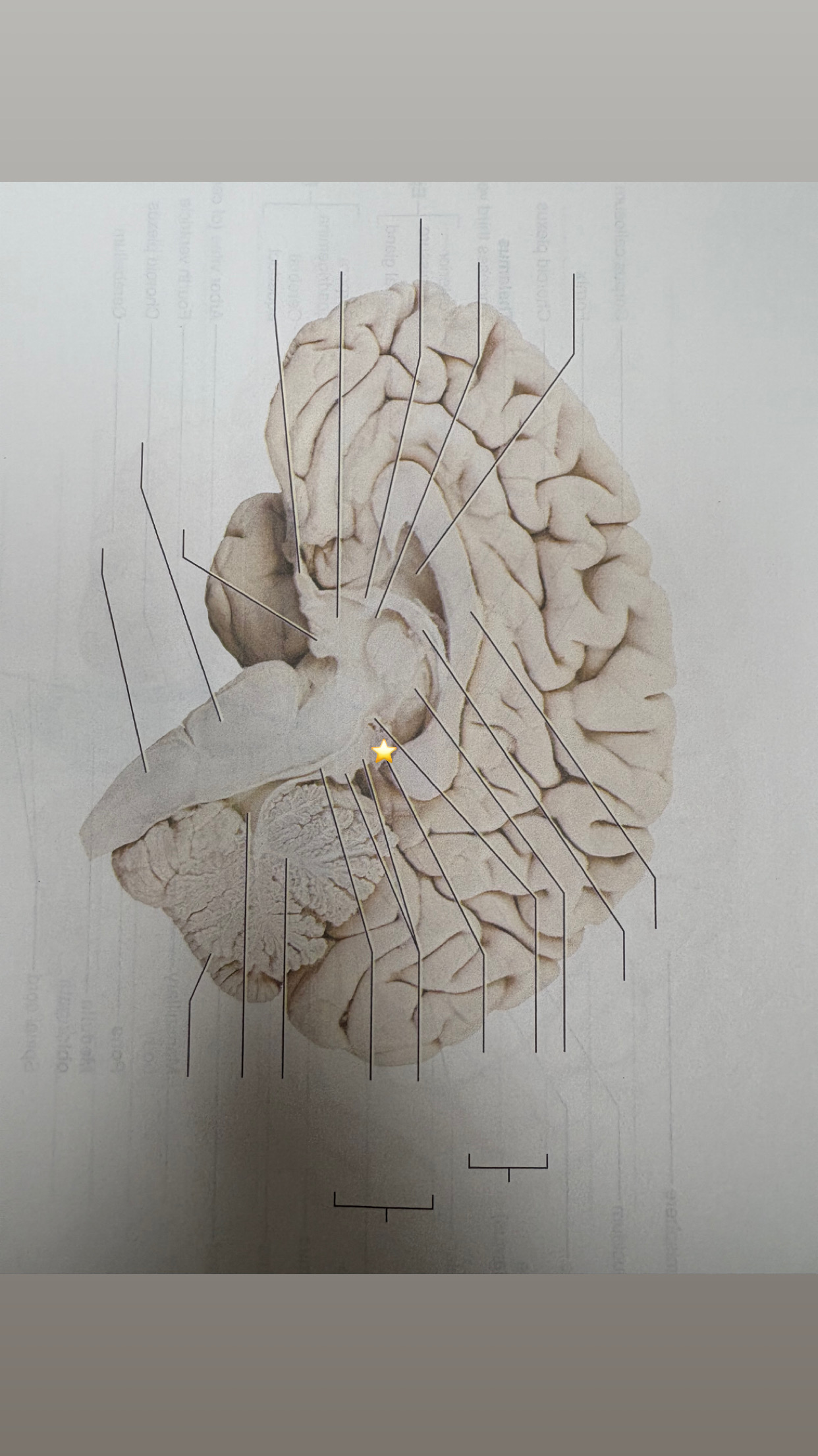 <p>name the starred structure</p>