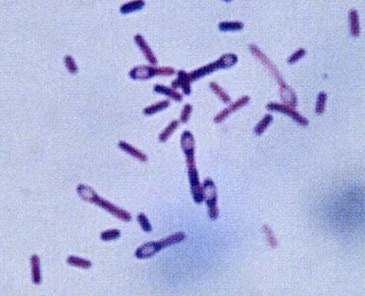<p>metabolically inert; long</p><p>(think endospore)</p>