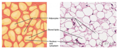 <p>brown fat cell</p>